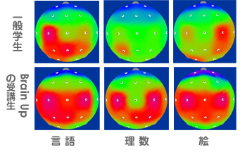 脳の活性化状態を表す写真